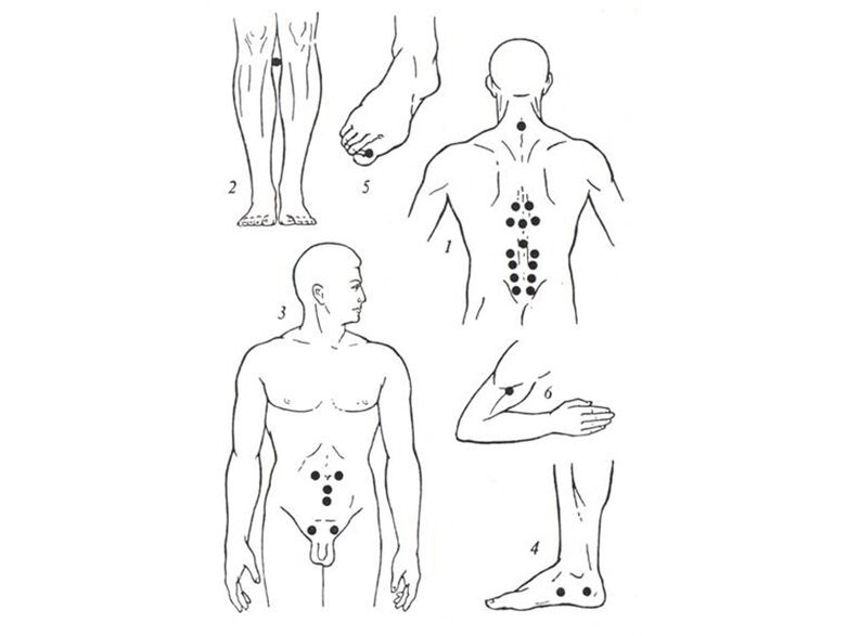 Massagem da acupuntura